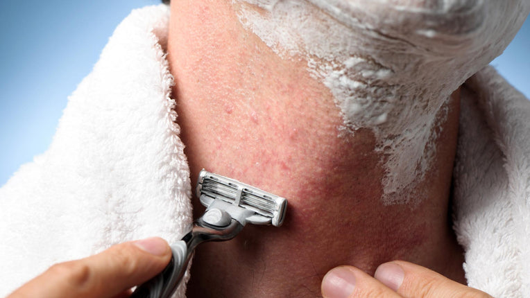 Razor Bumps On Arms What Are Razor Bumps & How To Treat Them