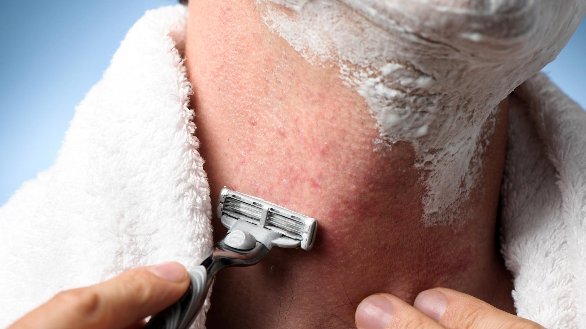 How to Prevent Razor Bumps | LloydsPharmacy