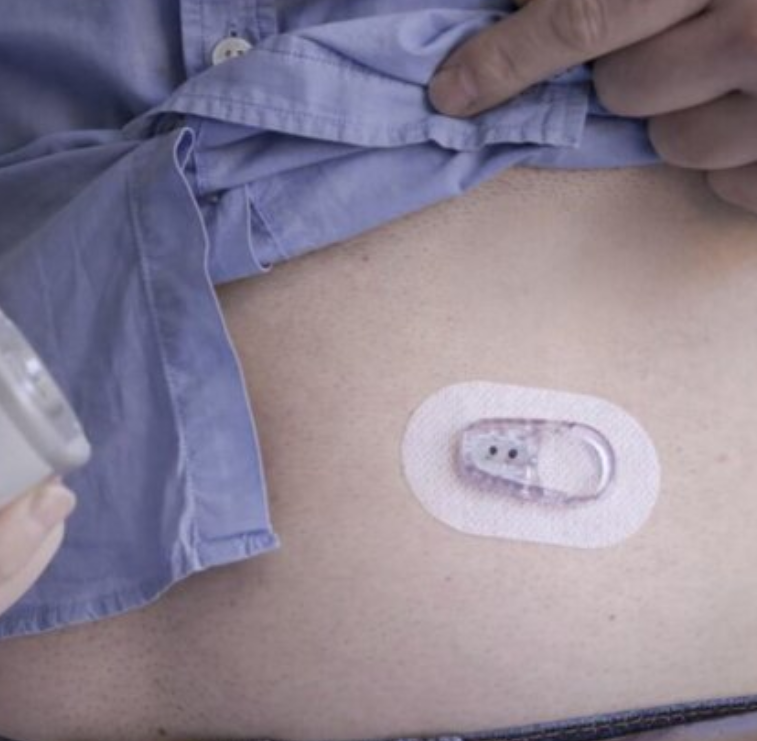 Dexcom ONE Sensor - 10 Days Supply | LloydsPharmacy